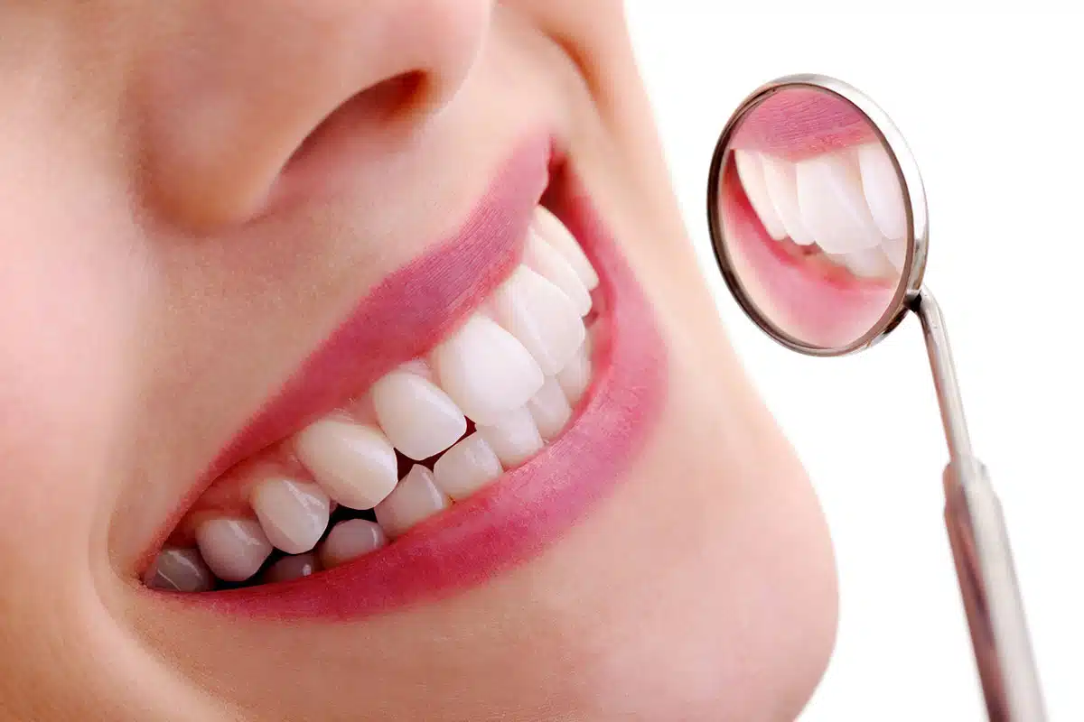 Creating Confident Smiles