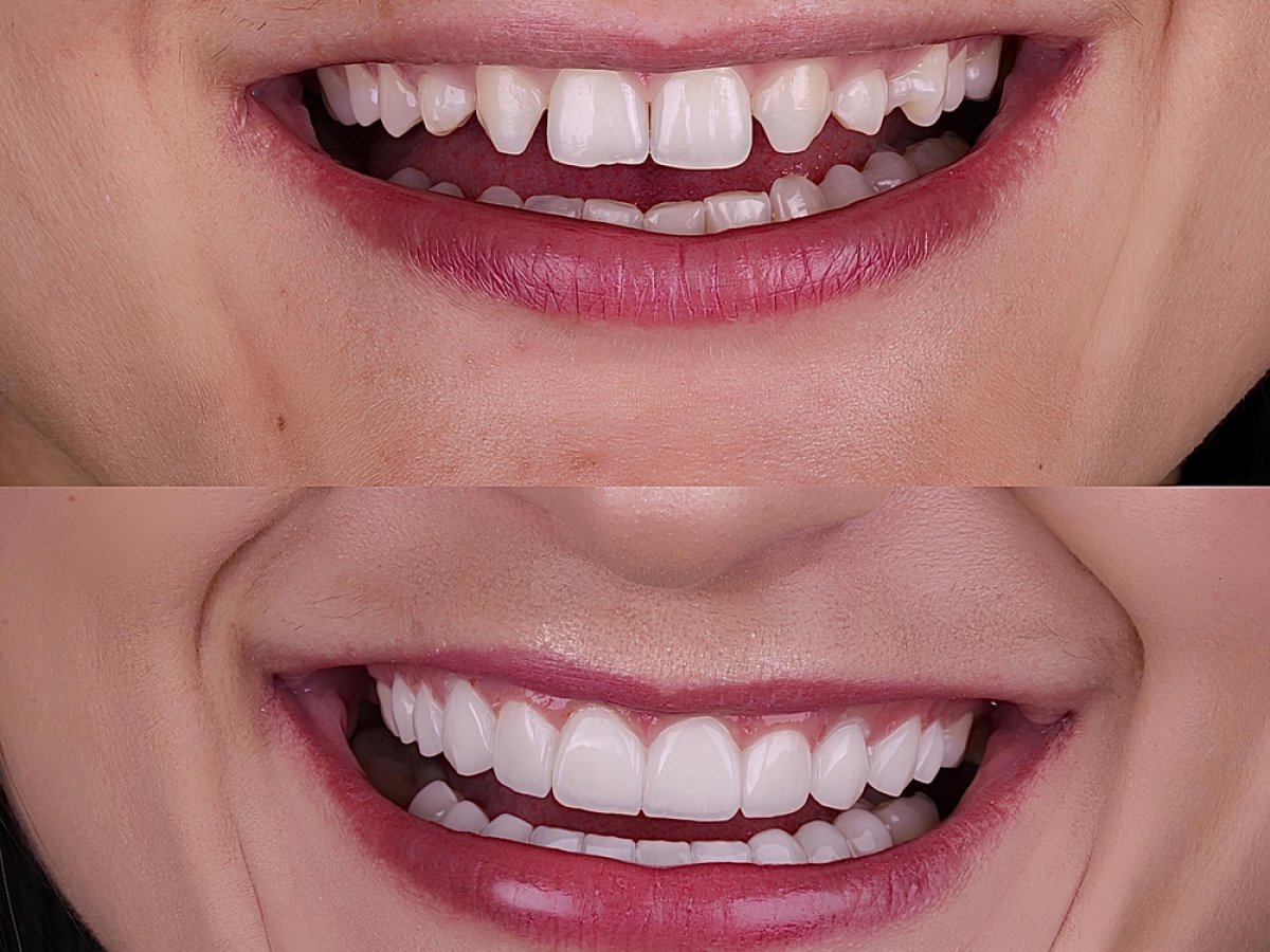Advancing Aesthetics